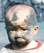 黑小孩